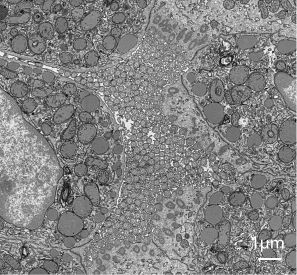 sem image analysis Testicular Sections